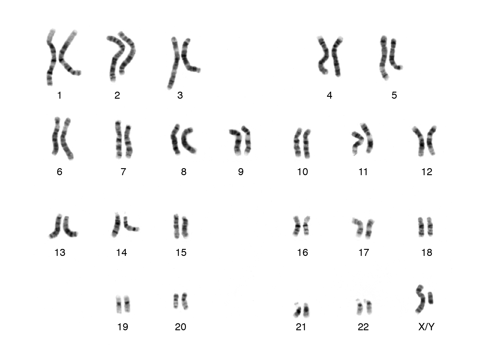 Kromosom yang terletak pada sel-sel tubuh disebut